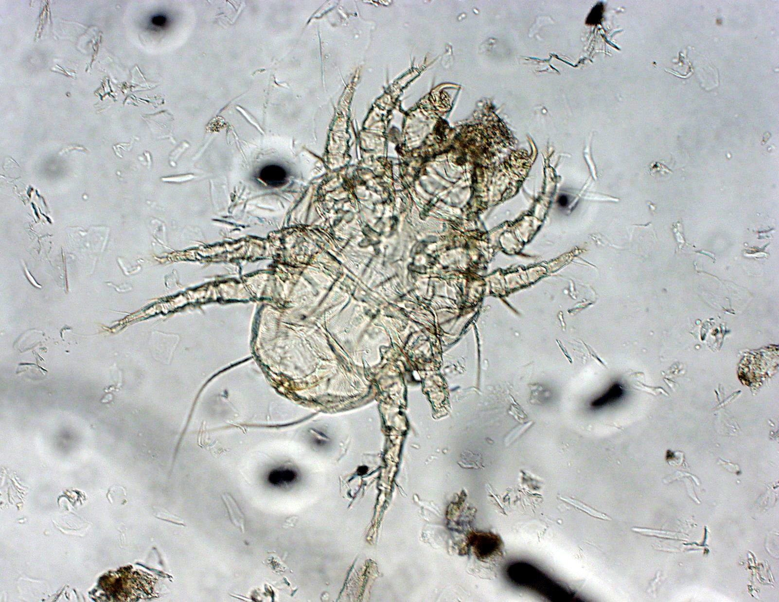 Schurft (scabies) (patientenfolder)