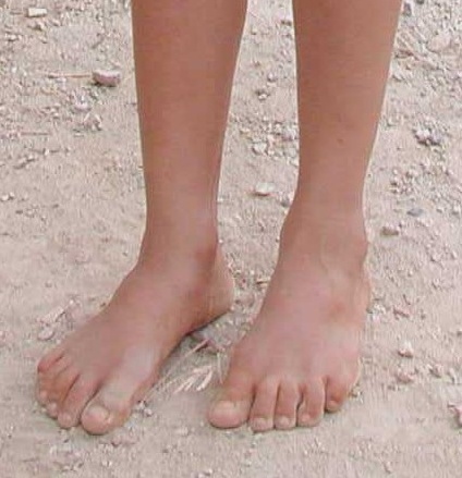 https://www.wormsandgermsblog.com/files/2010/01/Bare_feet1.jpg